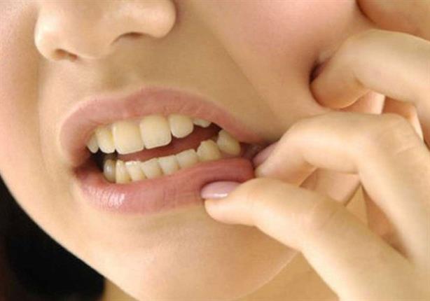 التهاب اللثة                                                                                                                                                                                            