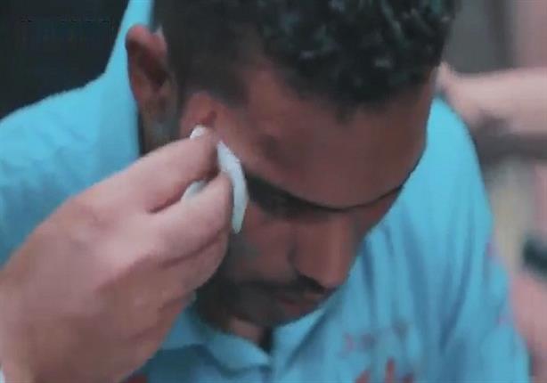 عليش يتسبب في إصابة ضيفه عقب إنفجار باستوديو التصوير - فيديو