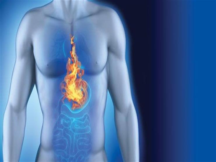 باحثون يكشفون عن جهاز دقيق يساهم في علاج حرقة المعدة