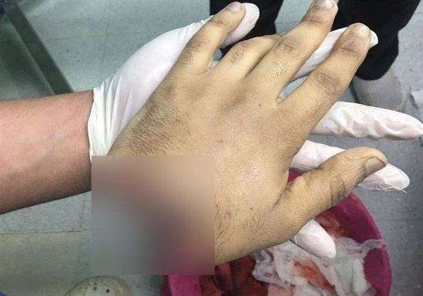 بالصور قطع كف شاب أمام المارة بالشرابية عقاب ا له على ال مصراوى