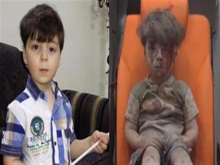 موسكو عن الطفل عمران: ندعو الصحفيين لزيارة سوريا بدلاً من الترويج لصور وقصص مفبركة  