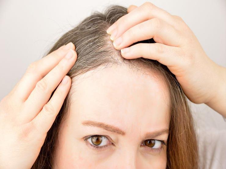 هل الضغط النفسي يسبب شيب الشعر؟