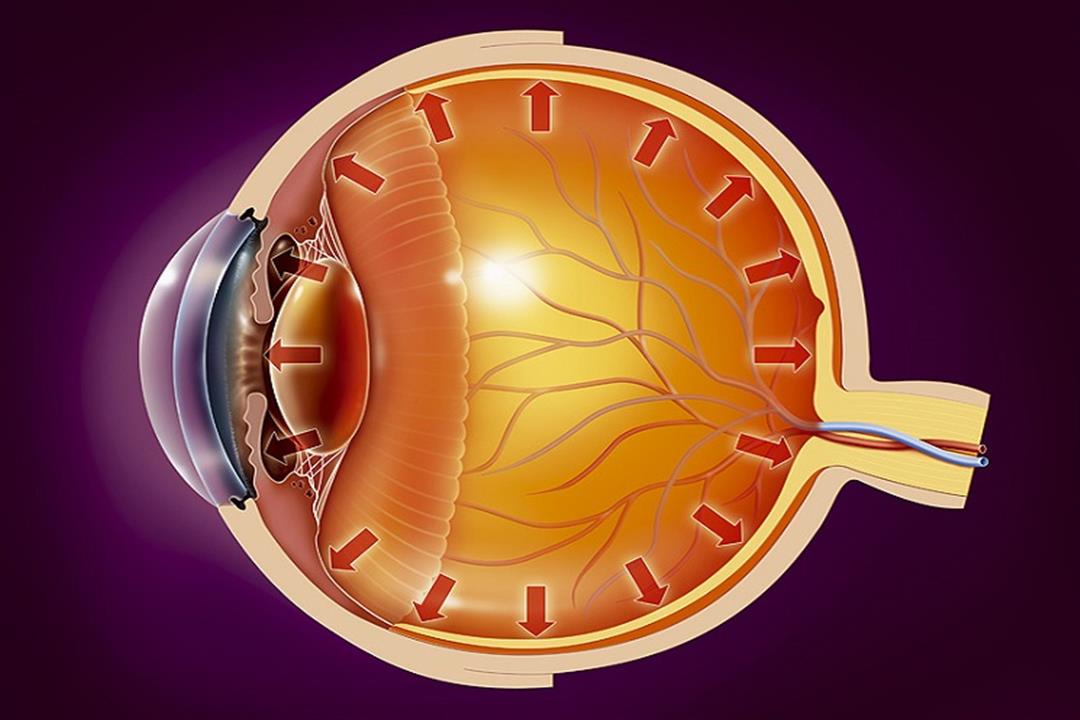  التهاب العصب البصري.. إهماله يؤدي للعمى والعلاج بسيط