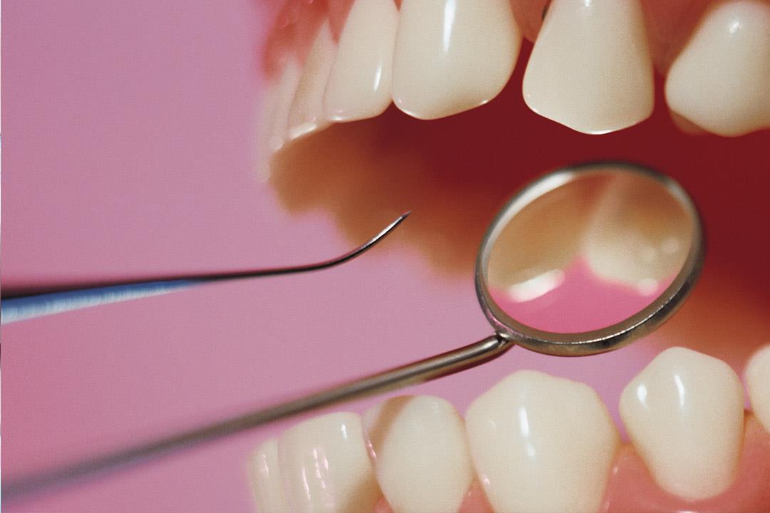 «خلخلة الأسنان» أعراض لهذه الأمراض 