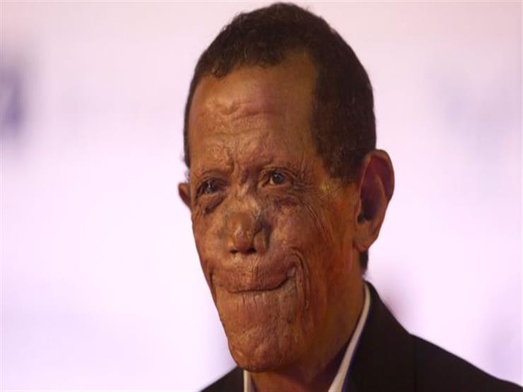 بي بي سي: "يوم الدين" رحلة ناجٍ من مستعمرة جذام في مصر بي بي سي: "يوم الدين" رحلة ناجٍ من مستعمرة جذام في مصر