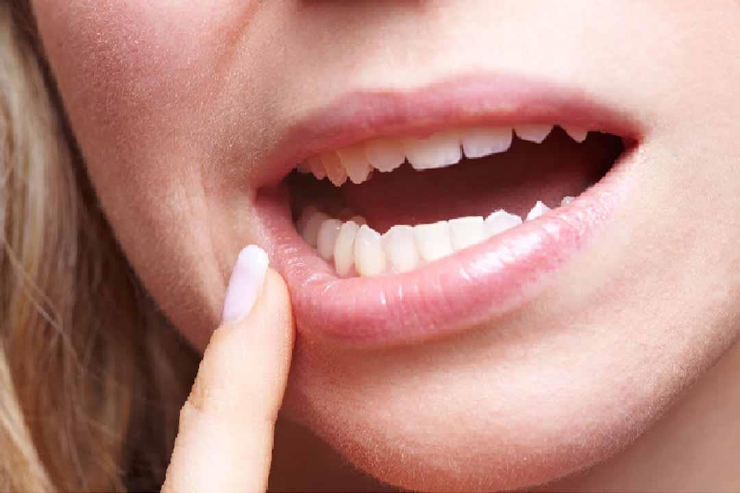  فوائد عديدة لـ"مساج اللثة".. بينها حماية الأسنان من التساقط