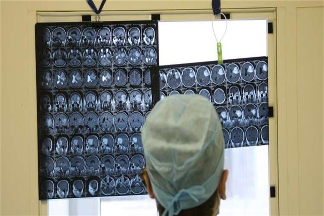 جراحون هنود ينجحون في إزالة «أكبر ورم دماغي».. كم يزن؟