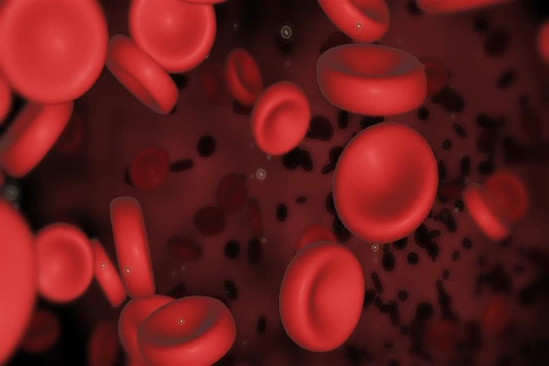 ما أسباب نقص كريات الدم الحمراء وكيف نتعامل معه؟