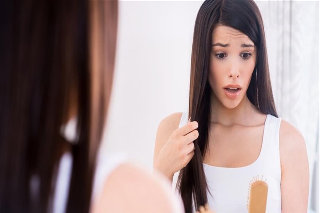 لتخفيف حدة الأعراض.. 5 نصائح لمرضى صدفية الشعر