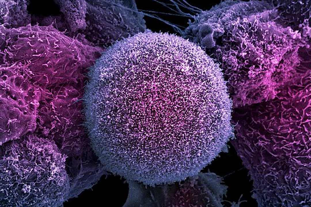 اكتشاف بروتين بالجسم مضاد للسرطان