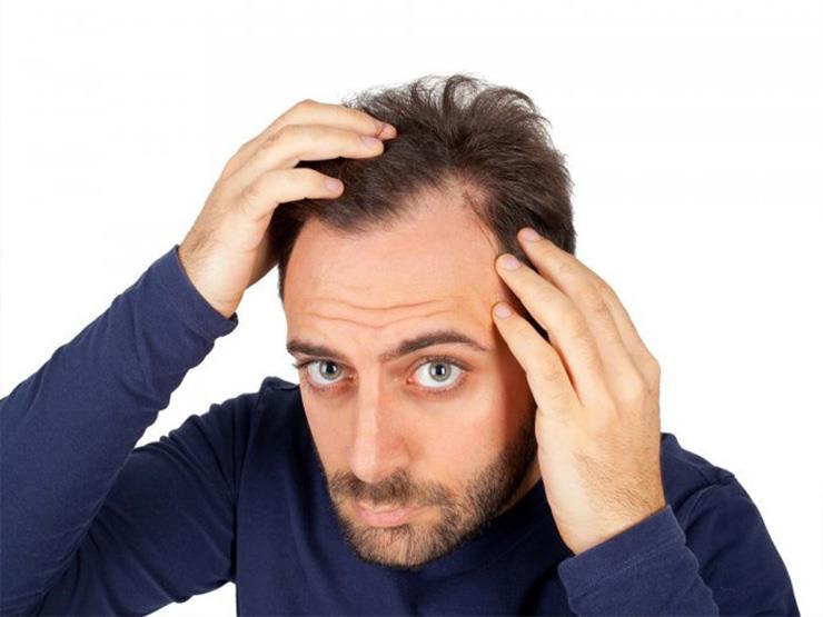 للرجل.. احرص على هذه الأطعمة للوقاية من "الصلع" للرجل.. احرص على هذه الأطعمة للوقاية من "الصلع"