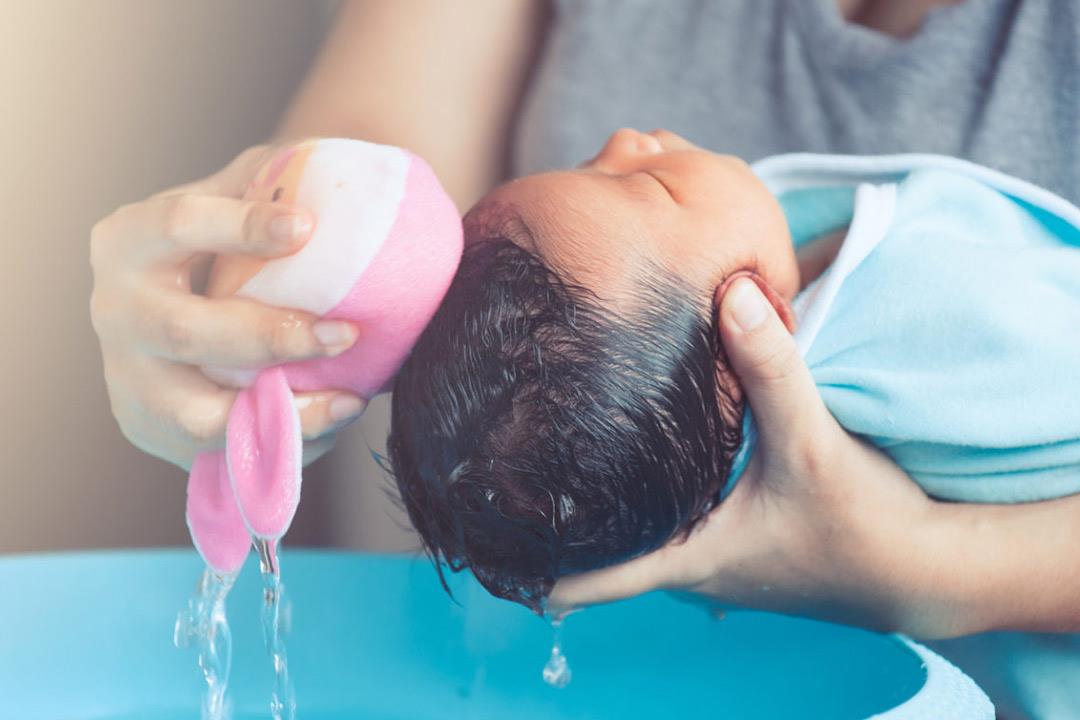 طريقة طبيعية لعلاج قشرة الشعر عند الرضع 