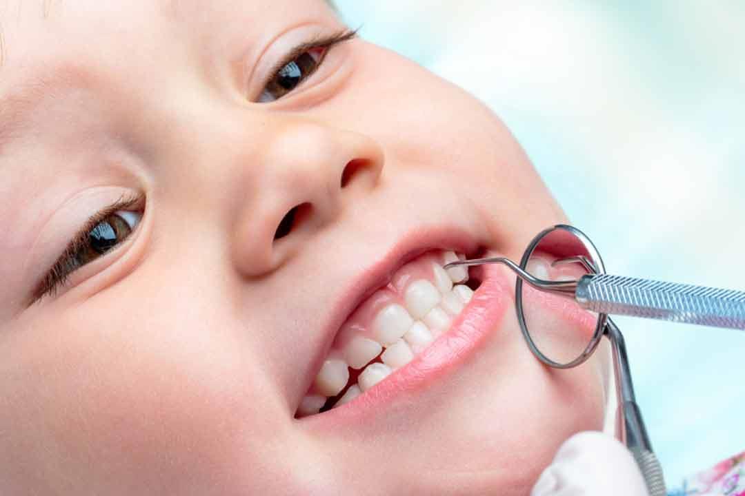 نصائح للوقاية من تآكل اسنان الاطفال الامامية