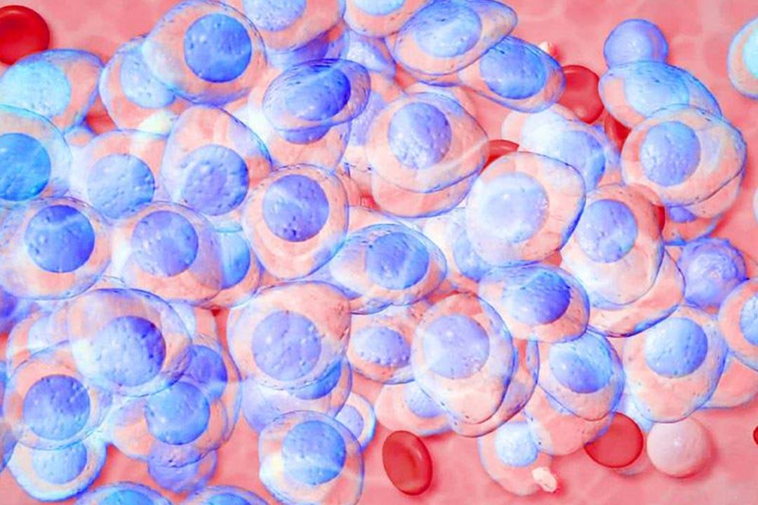 FDA تعتمد عقار جديد لعلاج "المايلوما المتعددة"