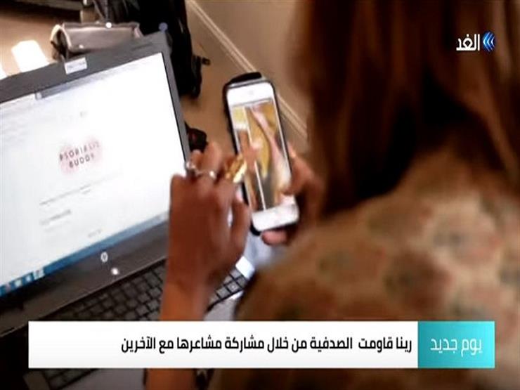 فتاة بريطانية تغلبت على مرض الصدفية بـ"انستجرام" – فيديو