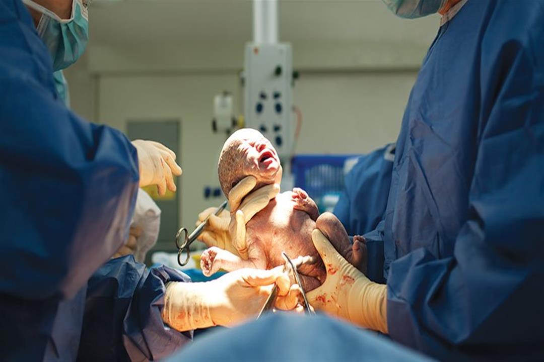 دراسة تحذر: الولادة القيصرية تعرض الأطفال لخطر الإصابة بالربو
