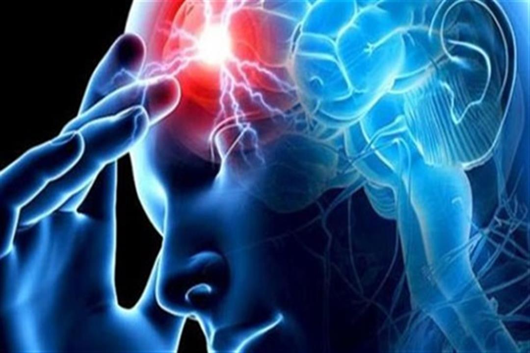 دراسة: خطورة السكتة الدماغية تتوقف على اختلاف العِرق 