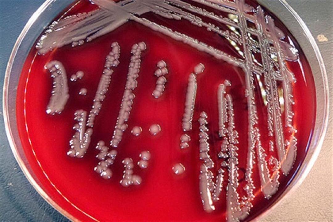 تصيب البشر.. اكتشاف نوع جديد من البكتيريا آكلة اللحم 