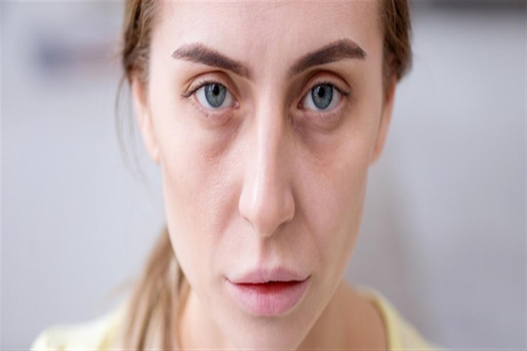 5 مشكلات صحية تظهر أعراضها على الوجه.. منها اضطرابات الغدة الدرقية