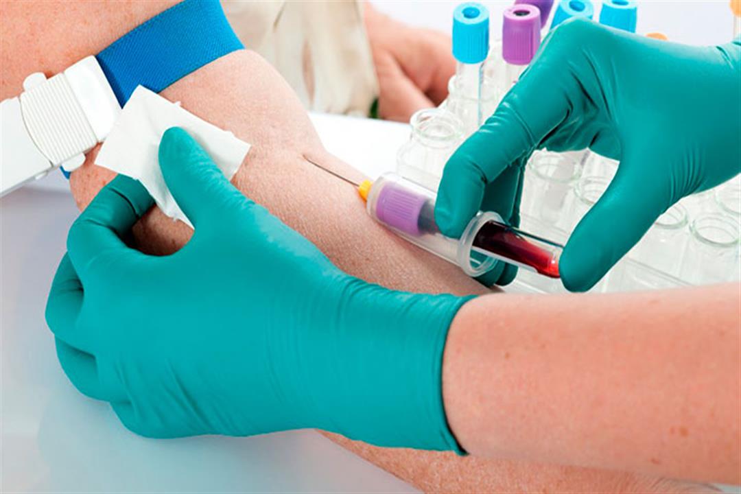 تحاليل مهمة 3