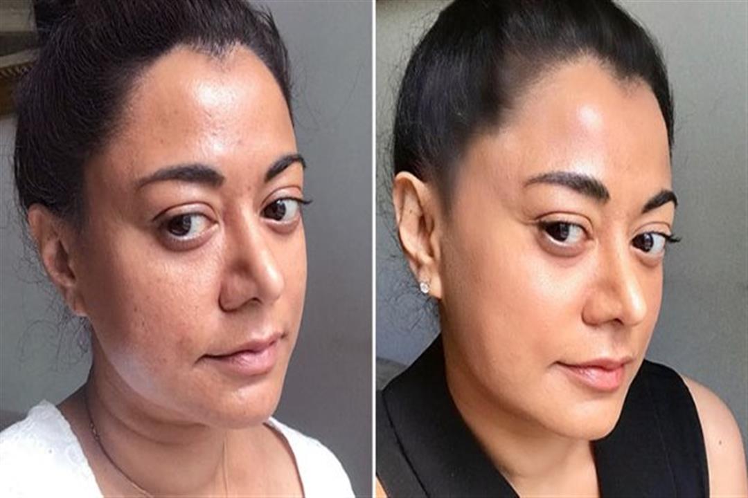 تجربتي مع الحلزون للوجه ومكونات جل الحلزون وفوائدها للبشرة مدونة صدى