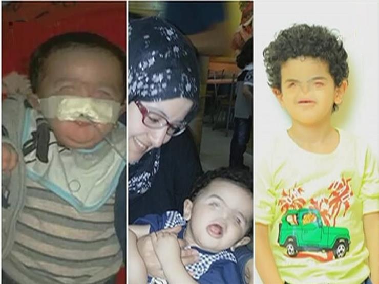 متعاطفًا مع أول طفل مصري يولد دون أنف.. فلوكس: "هودّيه المدرسة بنفسي"