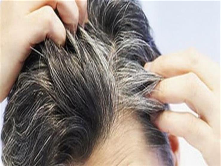 منها البصل تناول هذه الأطعمة تكافح الشعر الأبيض مصراوى