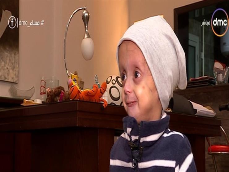 "مساء دي إم سي" يعرض تقريرًا عن الطفل زين هيثم المصاب بالشيخوخة المبكرة