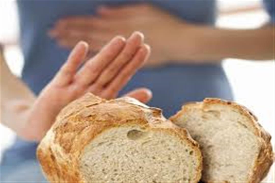 حساسية الغذاء