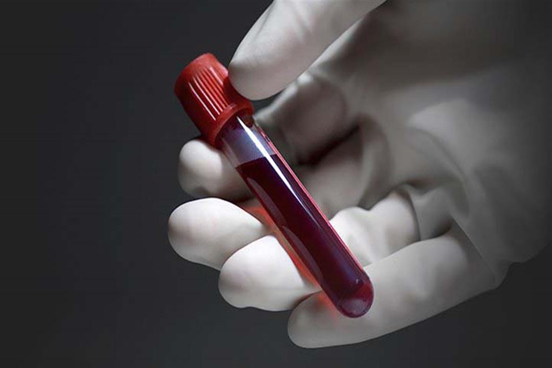 "FDA" تحذر من اختبار منزلي يقيس تجلط الدم