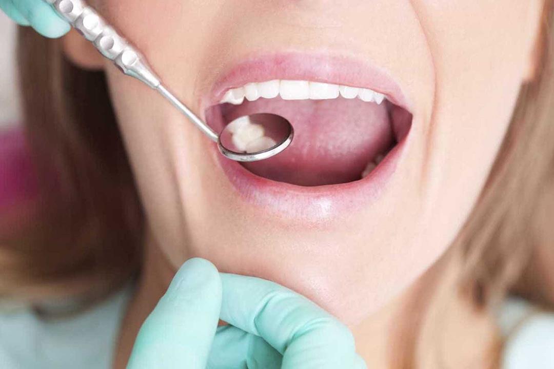  أسباب متعددة للبقع السوداء على الأسنان.. كيف نتخلص منها؟