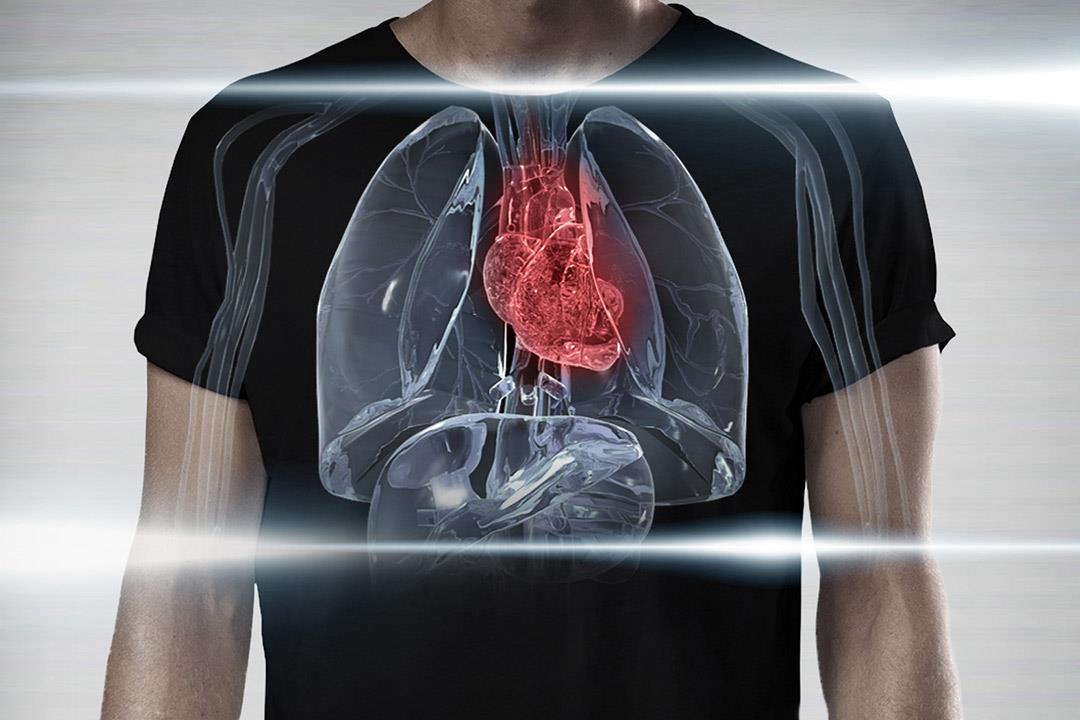 جهاز جديد يعالج مشكلات القلب أفضل من الجراحات المفتوحة
