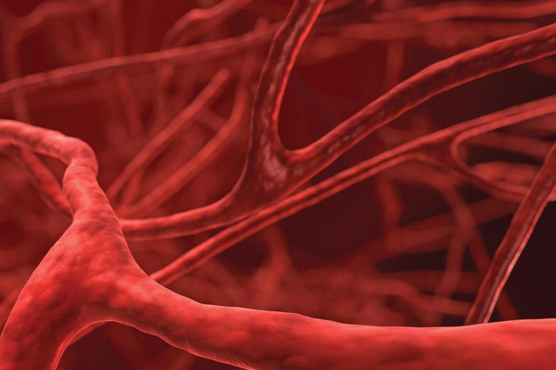 ما هي الأمراض التي تصيب الأوعية الدموية؟ | الكونسلتو