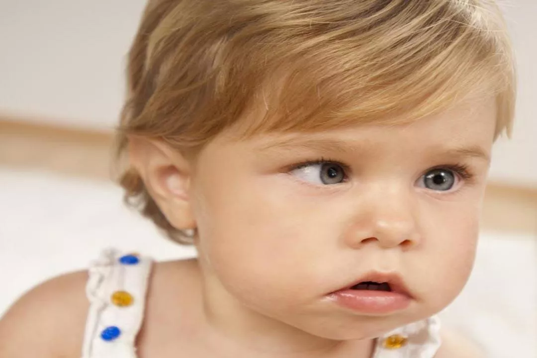 الحول عند الأطفال  