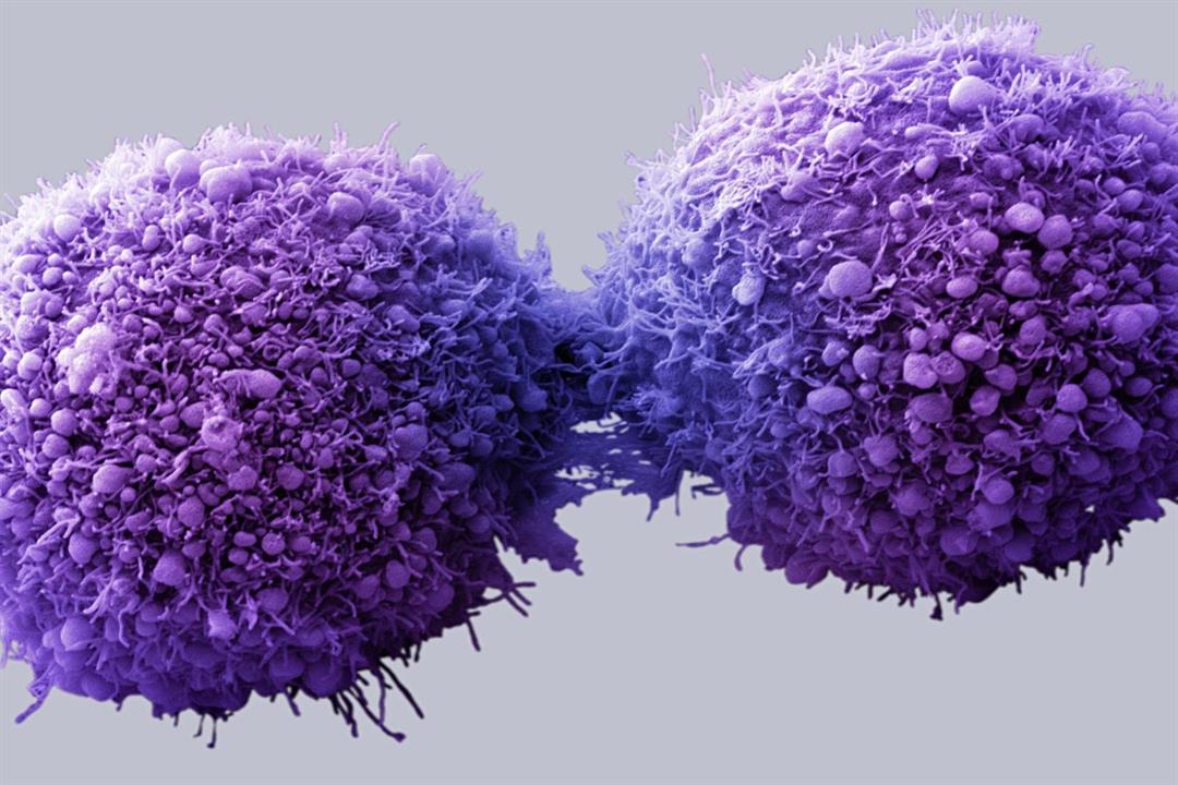 علماء يكتشفون وسيلة جديدة تدمر السرطان تماما.. تعرف عليها