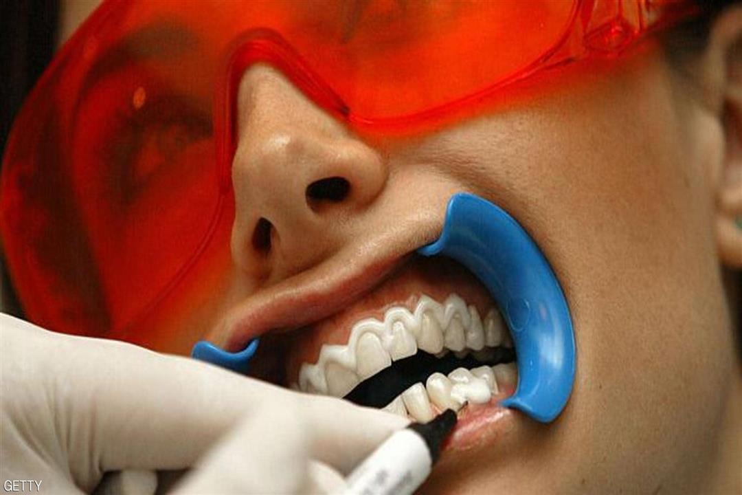 انتبه.. خطر لم يخبرك به الأطباء عن تبييض الأسنان