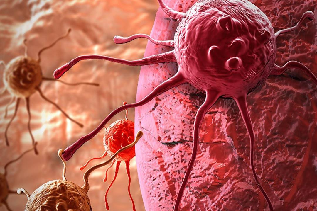 تطوير وسيلة جديدة لمحاربة سرطان الدم الحاد