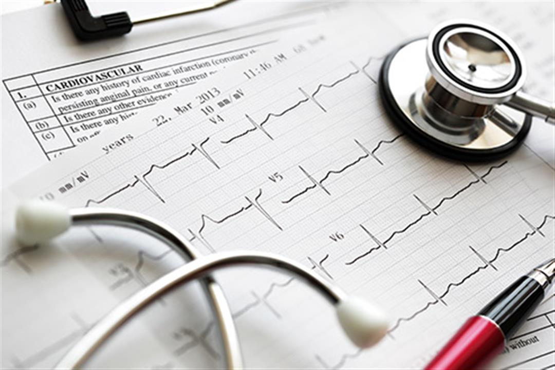 493ss_thinkstock_rf_cardiovacular_test_results
