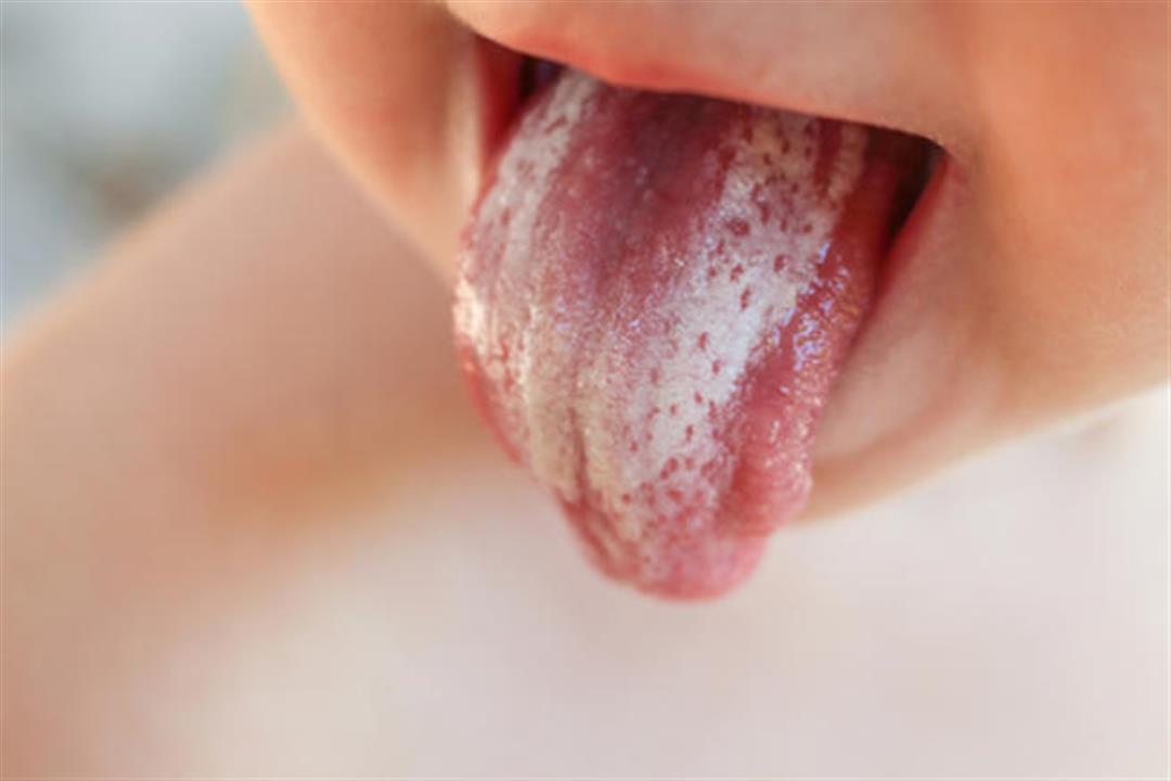 jdTraQ72xx8RYG5tpzrwMg