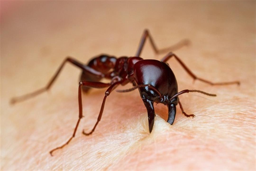قرصة النمل تهددك بمضاعفات خطيرة.. إليك أعراضها وطرق علاجها