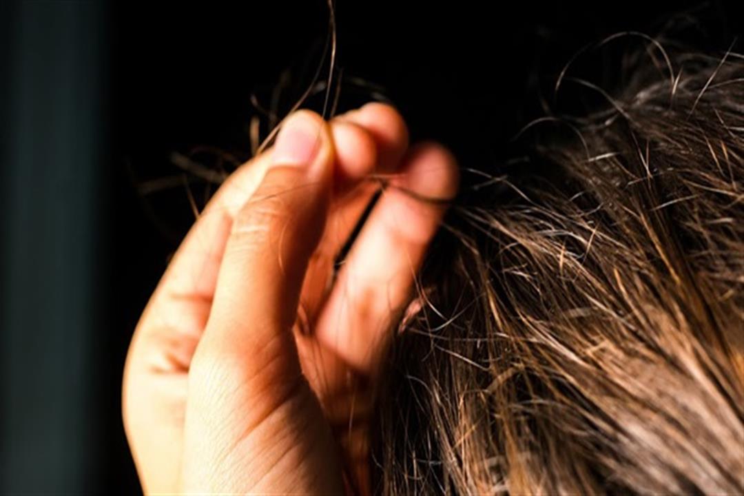 دراسة: تحليل شعر الرأس يساهم في تشخيص الاكتئاب