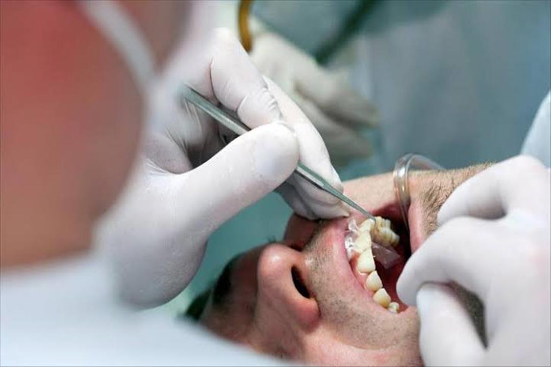 وداعًا لحشو الأسنان.. الطب الصيني يقدم حل جديد 