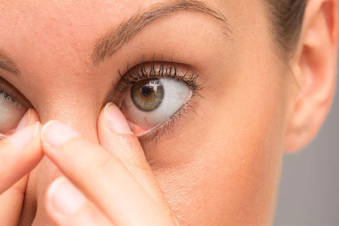 8 طرق بسيطة لإزالة الرمش من داخل العين (صور)