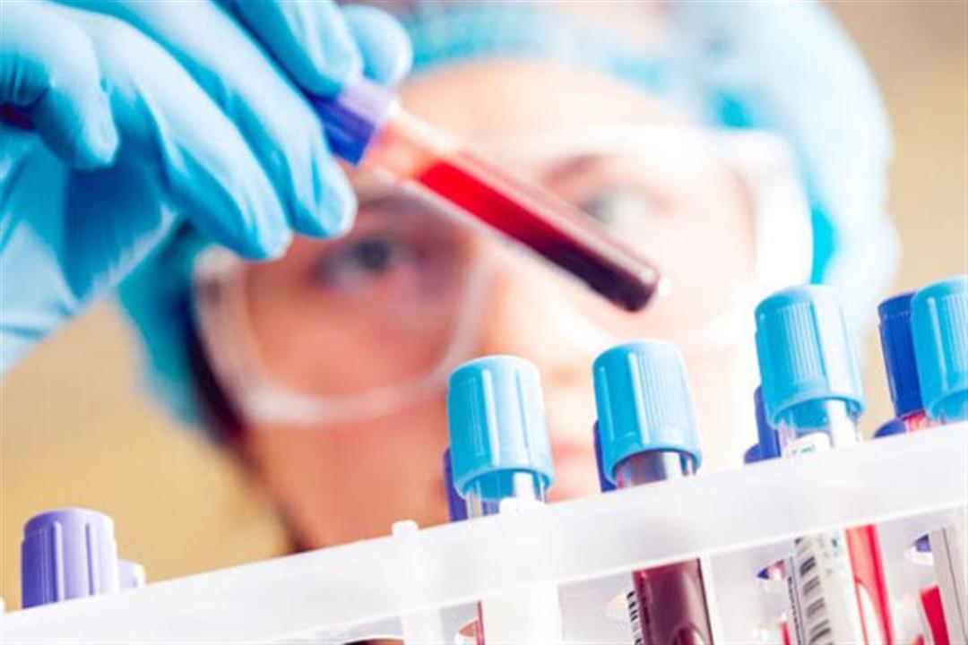 تحليل دم للشباب يتنبأ بالوفاة المبكرة قبل 40 عامًا