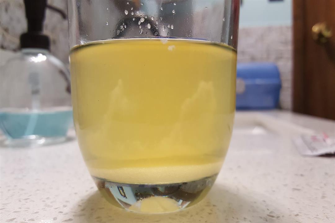 d2fe7-20170830_074656