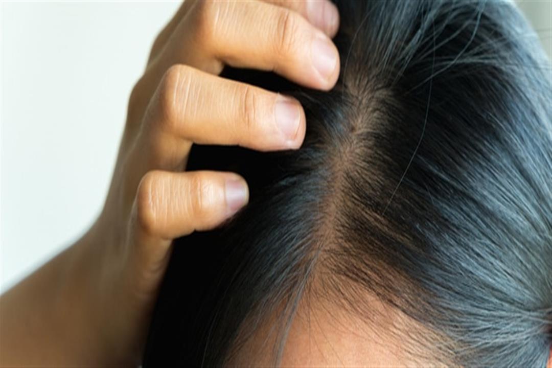 بديل آمن للفياجرا.. 6 فوائد صحية لعشبة العنزة (صور55