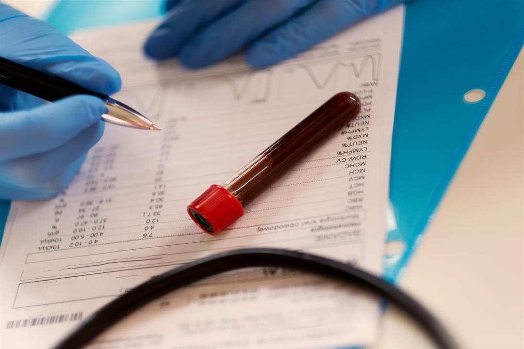  6 أشياء يبقيها الأطباء سرًا إذا ظهرت في نتائج اختبار الدم