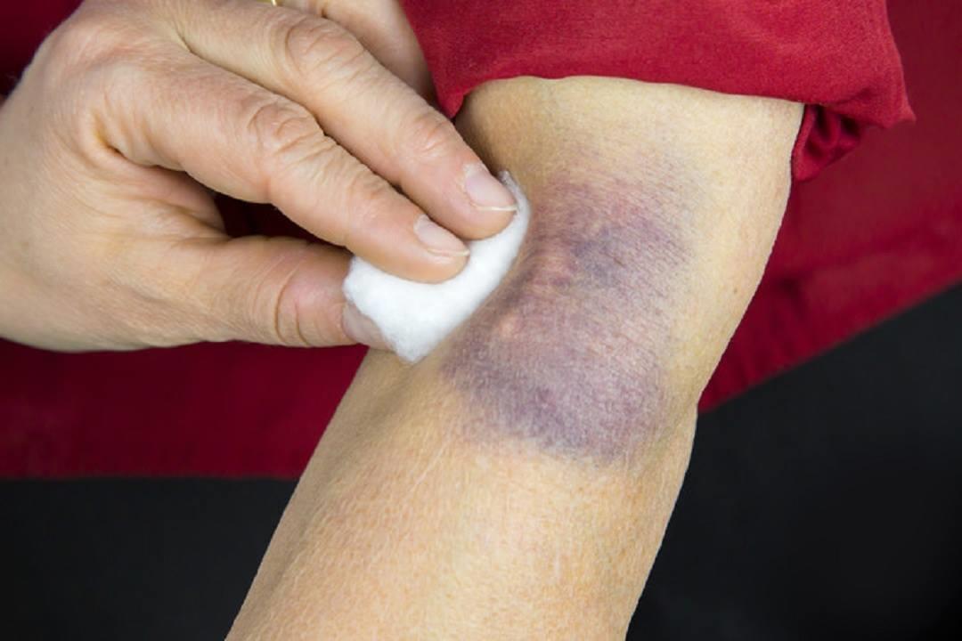 2018_1_22_18_39_53_848