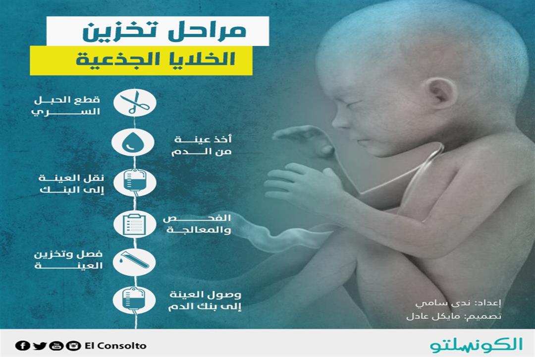 مراحل تخزين الحبل السري                                                                                                                                                                                 