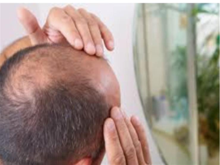 Discover a simple and effective treatment for the problem of baldness